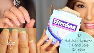 How to Get Rid of Yellow Nails amp Dry Hands  CLOSED Giveaway LOccitane amp London Butter [upl. by Clerissa]