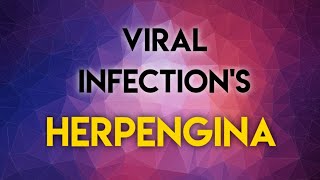 VIRAL INFECTIONS  HERPENGINA [upl. by Annis]