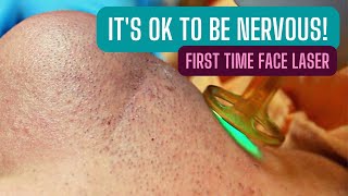 FIRST TIME LASER HAIR REMOVAL  FULL FACE [upl. by Eibor]