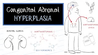 What is Congenital Adrenal Hyperplasia CAH [upl. by Nauaj488]