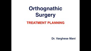 Treatment Planning for Orthognathic Surgery [upl. by Wilkins]