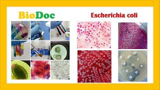 BACTERIOLOGÍA 🦠🦠🔬  ENTEROBACTERIAS  Escherichia coli [upl. by Naginarb253]