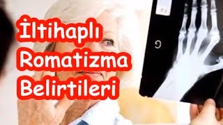 İltihaplı Romatizma Belirtileri [upl. by Blaine]