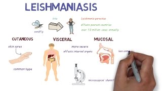 What is Leishmaniasis An introduction and overview [upl. by Ammej374]