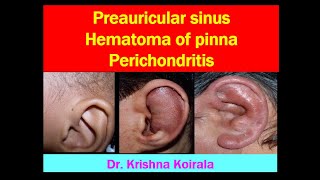 Preauricular sinus  Hematoma of pinna  Perichondritis of pinna  Dr Krishnas ENT Lectures [upl. by Ellekram]