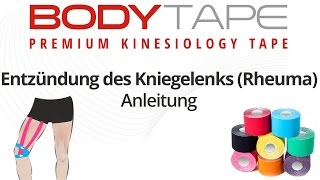 Kinesiology Tape Anleitung Entzündung des Kniegelenks Rheuma [upl. by Whit324]