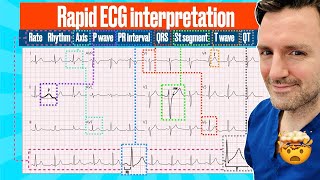 Rapid structured ECG interpretation A visual guide FOR REVISION electrocardiogram [upl. by Buskirk186]