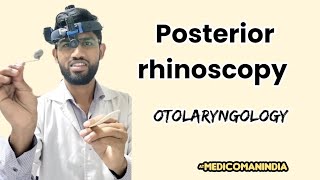 Posterior Rhinoscopy  ENT  medicomanindia [upl. by Cerracchio]