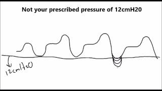 Should You Use EPR CFLEX or AFLEX For CPAP and APAP users [upl. by Berliner]