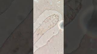 Face mites Under the Microscope interesting skincare viralshorts [upl. by Charmane]