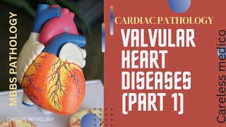 CARDIAC PATHOLOGY VALVULAR HEART DISEASES lecture 10patho cvs mbbs pathoma robbins [upl. by Mazlack]