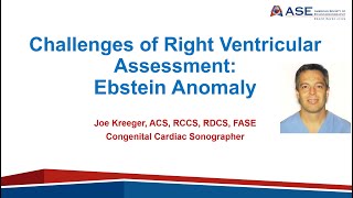 Challenges of Right Ventricular Assessment in Ebsteins Anomaly Using Echocardiography [upl. by Weiman]