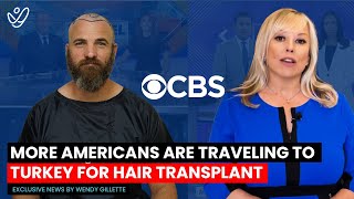 The Surprising Reasons Turkey is Becoming the Hair Transplant Capital CBSNews WendyGillette [upl. by Micky]