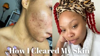 Skincare Routine For Hyperpigmentation amp Dark Spots  CeraVe [upl. by Cott]