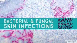 Infectious Dermpath bacterial amp fungal Board Review for Dermatology amp Pathology 20 cases [upl. by Leagiba]