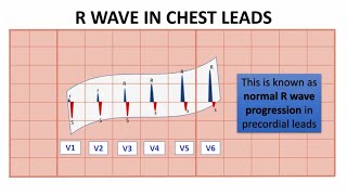 Normal R wave progression NORMAL R WAVE IN LIMB AND CHEST LEADS quotNORMAL ECG VALUESquot  NARCOSIS😴🤤 [upl. by Bernarr]