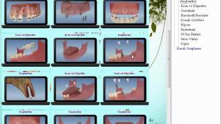 NovaSoft Dental Patient Education 3D Animation Software for Dentist [upl. by Aninaig]