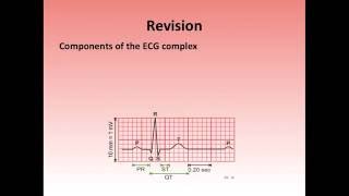 ECG changes associated with electrolyte disturbances [upl. by Annairba898]