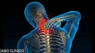 Cervicalgia crónica valoración y tratamiento [upl. by Merrili302]