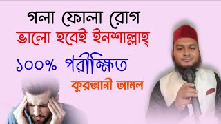 গলা ফোলা রোগ দূর করার উপায় আমল দোয়া অজিফা  gola fola rog dur korar upay amol doah ojifa todbir [upl. by Israel111]