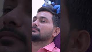 Best Skin Clinic in Pune  Journey to Fuller Hair with PRP 💇‍♂✨ prptreatment hairprp hairloss [upl. by Enihpets116]