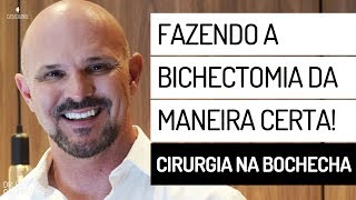 FAZENDO A BICHECTOMIA DA MANEIRA CERTA  CIRURGIA NA BOCHECHA [upl. by Settera]