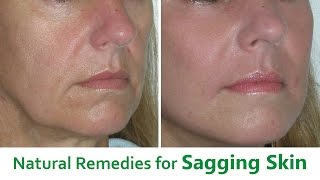 The Best 5 Natural Remedies for Sagging Skin [upl. by Enial]