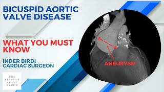 Why is Bicuspid Valve Disease Different [upl. by Assinna]