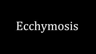 How to pronounce Ecchymosis [upl. by Leamse]