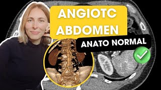 AngioTC de abdomen Anatomía normal y secretos para la mejor evaluación✅ [upl. by Itnava]