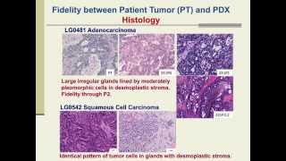 PatientDerived Xenografts for Cancer Therapeutics Development and Predictive Modeling [upl. by Yllas]