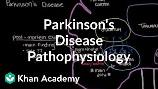 Putting it all together  Pathophysiology of Parkinsons disease  NCLEXRN  Khan Academy [upl. by Halimak]