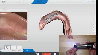 Scanning a Denture with CEREC PrimeScan 511 [upl. by Ennobe822]