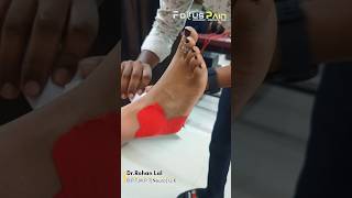 Ankle Sprain Taping  Ankle Stability  Sprained Ankle [upl. by Reinaldo]