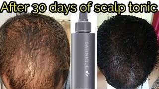 Amway scalp tonic demo [upl. by Kristofer]