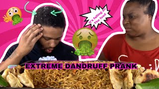 EXTREME DANDRUFF MUKPRANK amp CHEESY SPICY BLACKBEAN NOODLES MUKBANG [upl. by Aivekahs]