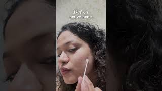 Overnight Acne Spot Corrector  How to Use [upl. by Ennahtebazile]