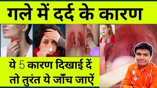 गले में दर्द हो तो क्या करना चाहिएगले में दर्दगले में दर्द होने के कारण  How To Cure Throat Pain [upl. by Jolee610]