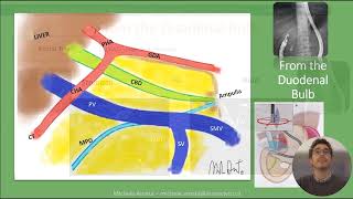 Linear EUS Anatomy of the PancreatoBiliary System by Michele Amata [upl. by Tsirc686]