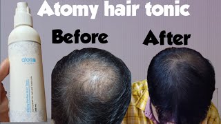 Atomy hair tonicAtomy hair tonic review [upl. by Torray10]