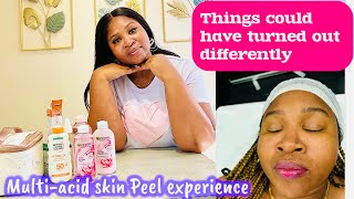 My MultiAcid Skin Peel Journey  Day 1  14 [upl. by Erdnua]