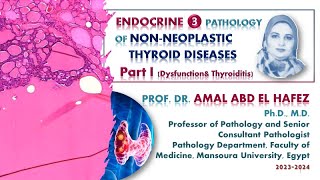 Thyroid dysfunction and thyroiditis  lecture شرح محاضرة [upl. by Haletky]