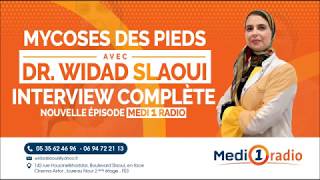 La mycose des pieds Dr Widad SLAOUI [upl. by Frederik]