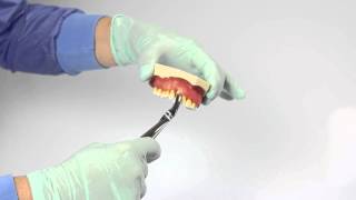 Tutorial 1  extracting forceps [upl. by Seuguh]