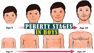 Puberty for boys stages 5 Things to Expect When Puberty Hits Boys [upl. by Sherrod]