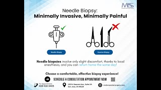 Needle Biopsy Minimally invasive minimally painful [upl. by Ybsorc816]