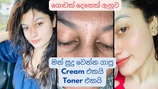 කුරුලෑ නැතුව සුදු උන රහස skincare beautytips white ningglowing nopimples girl cream toner [upl. by Laurie]