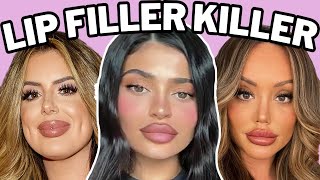 lip fillers will ruin you [upl. by Niai]