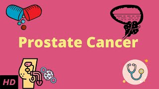 Prostrate Cancer Causes Signs and Symptoms DIagnosis and Treatment [upl. by Chancellor]