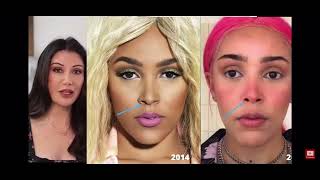 Lorry Hill  Doja Cat Plastic Surgery Analysis REUPLOADED [upl. by Enoek318]